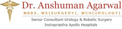 Best urologist in delhi