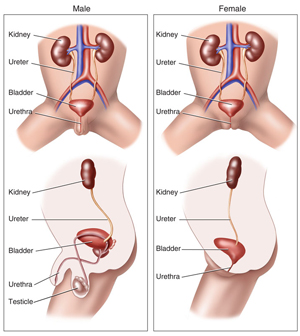 Kidney stone treatment in delhi